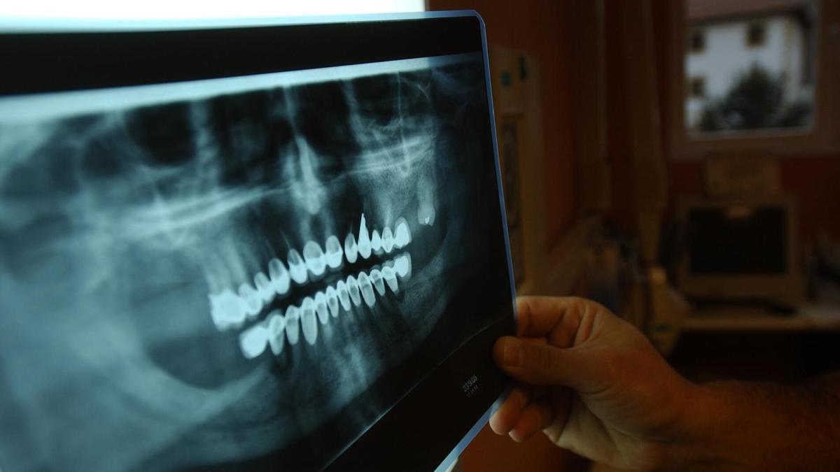 Un dentista sostiene una radiografía.