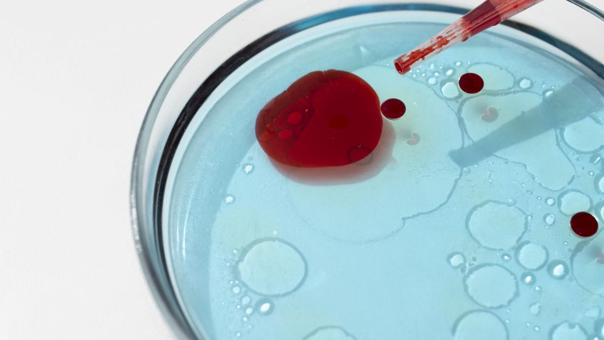 El cansancio, la palidez o la dificultad para concentrarse son algunos de los síntomas habituales.