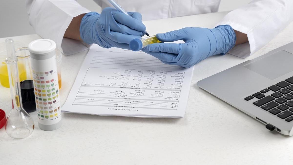 Una sanitaria realiza el análisis de una muestra de orina.