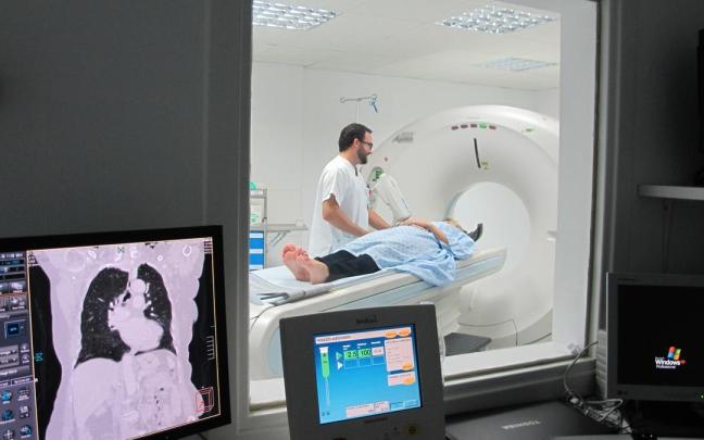 Ya existen experiencias piloto en el cribado del cáncer de pulmón.