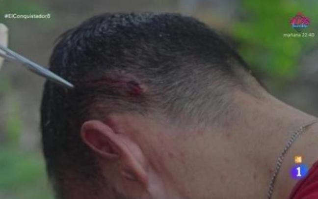 Un concursante se abre la cabeza en 'El Conquistador'.
