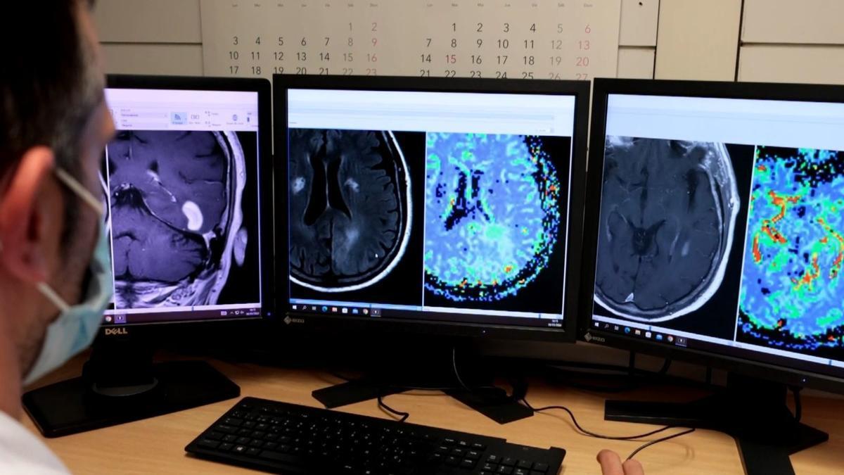 Imágenes de resonancia magnética de un cerebro.