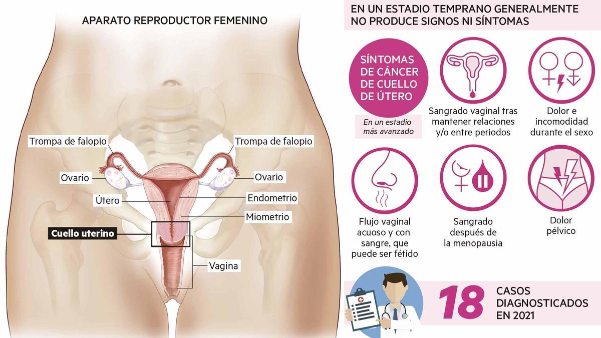 Gráfico sobre el cáncer de cérvix / Maitane Bernabeu