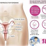 Gráfico sobre el cáncer de cérvix / Maitane Bernabeu