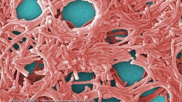 Imagen de bacterias de Legionella. EP