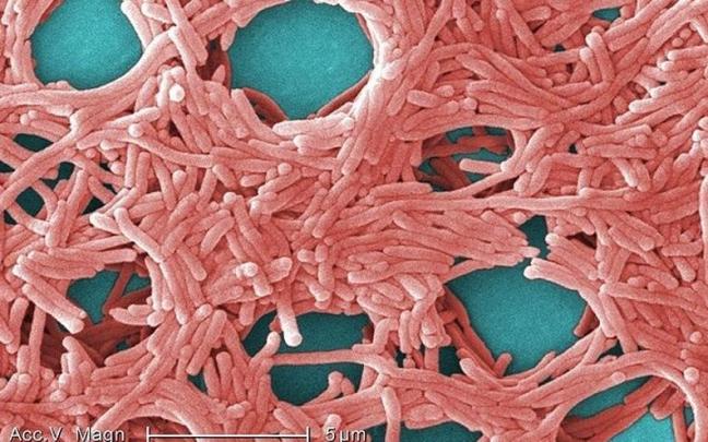 Imagen de bacterias de Legionella. EP